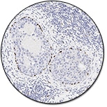 p63 Protein (Concentrate)