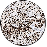 p63 Protein (Concentrate)