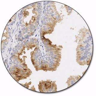 Prostate-Specific Membrane Antigen (Autostainer Link 48)