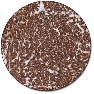 Caldesmon (Dako Omnis)