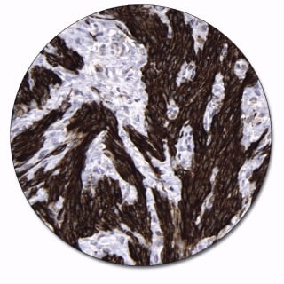 Caldesmon (Autostainer Link 48)