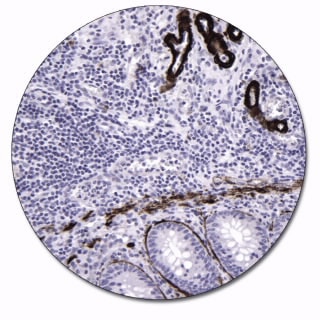 Caldesmon (Autostainer Link 48)