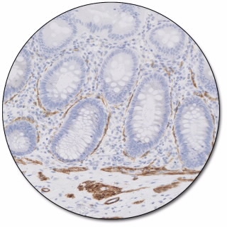 Caldesmon (Dako Omnis)