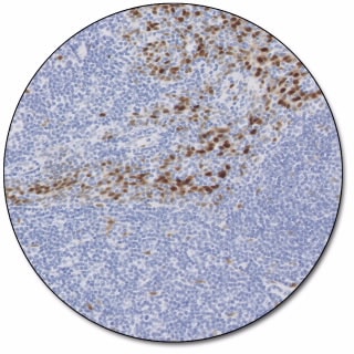 サイクリン D1 (ダコ Omnis 用)