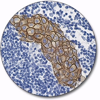 ダコ　HercepTest II