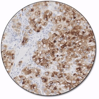 Renal Cell Carcinoma Marker (Concentrate)