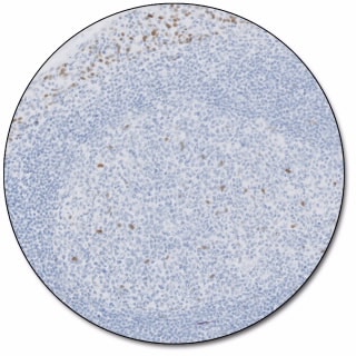 Estrogen Receptor α (Dako Omnis)