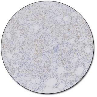 Estrogen Receptor α (Dako Omnis)