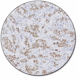 Estrogen Receptor α (Dako Omnis)