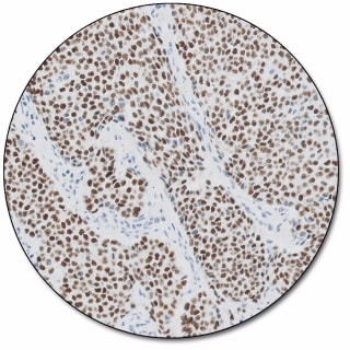 Estrogen Receptor α (Dako Omnis)