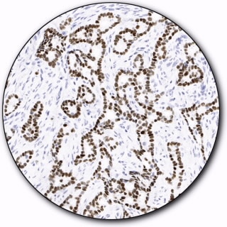Estrogen Receptor α (Autostainer Link 48)