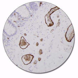 Von Willebrand Factor (Concentrate)