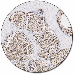 Prostein (Autostainer Link 48)