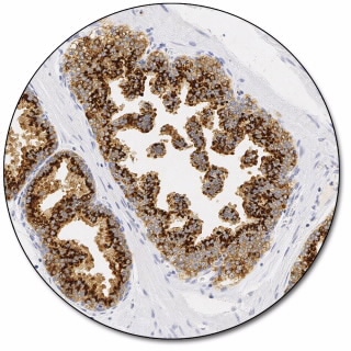 Prostein (Autostainer Link 48)