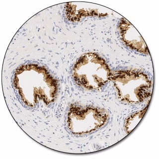 Prostein (Autostainer Link 48)