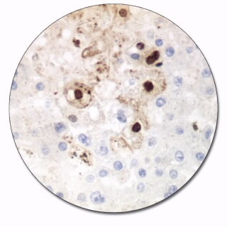 Herpes Simplex Virus Type 1 (Autostainer Link 48)