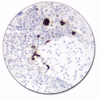 Herpes Simplex Virus Type 1 (Autostainer Link 48)