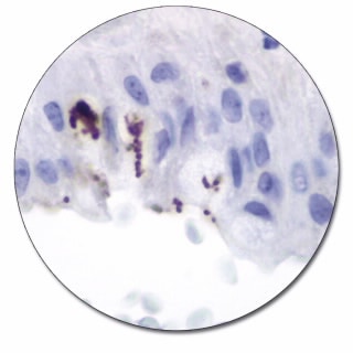 ヘリコバクター ピロリ (濃縮抗体)