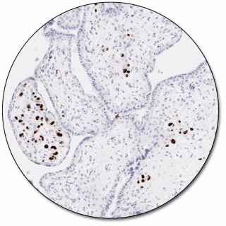 Cytomegalovirus (Concentrate)