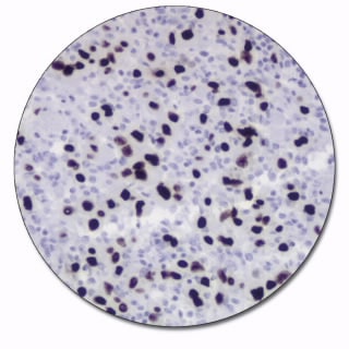 Cytomegalovirus (Concentrate)