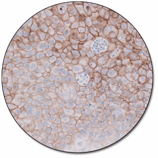 PD-L1 IHC 22C3 pharmDx for Dako Omnis 