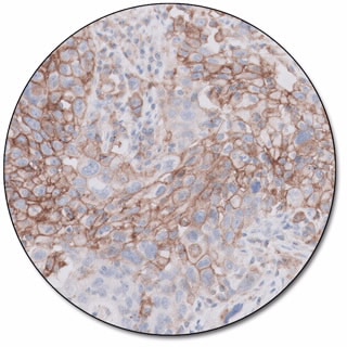 PD-L1 IHC 22C3 pharmDx for Dako Omnis 