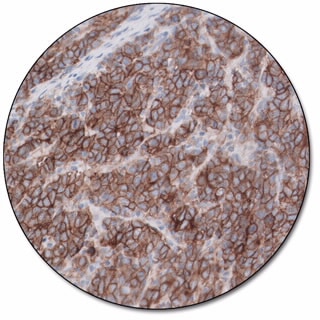 PD-L1 IHC 22C3 pharmDx for Dako Omnis 