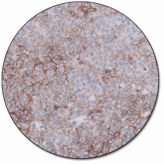 PD-L1 IHC 22C3 pharmDx for Dako Omnis 