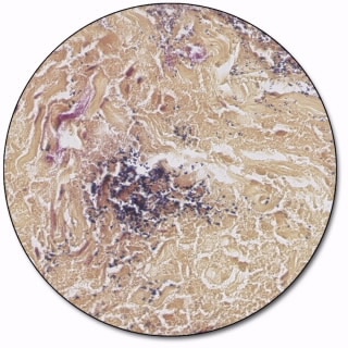 Gram Yellow Stain Kit, Artisan