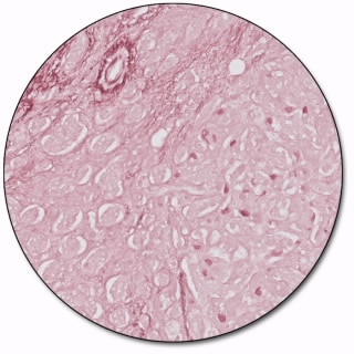 Orcein Stain Kit, Artisan