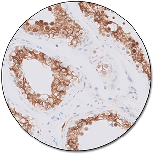 Inhibin α (Dako Omnis)