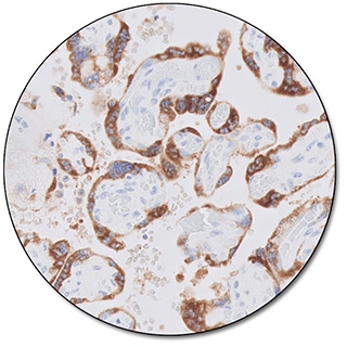 Inhibin α (Dako Omnis)