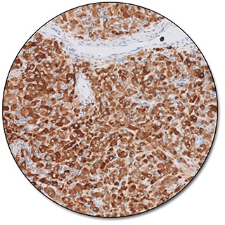 Inhibin α (Dako Omnis)