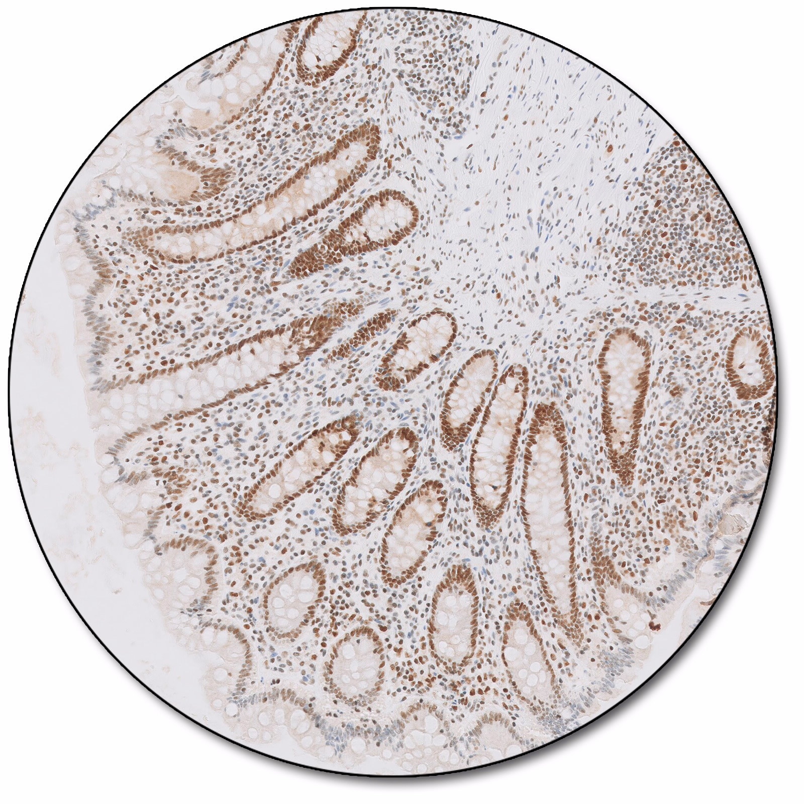 MutL Protein Homolog 1 (Dako Omnis)