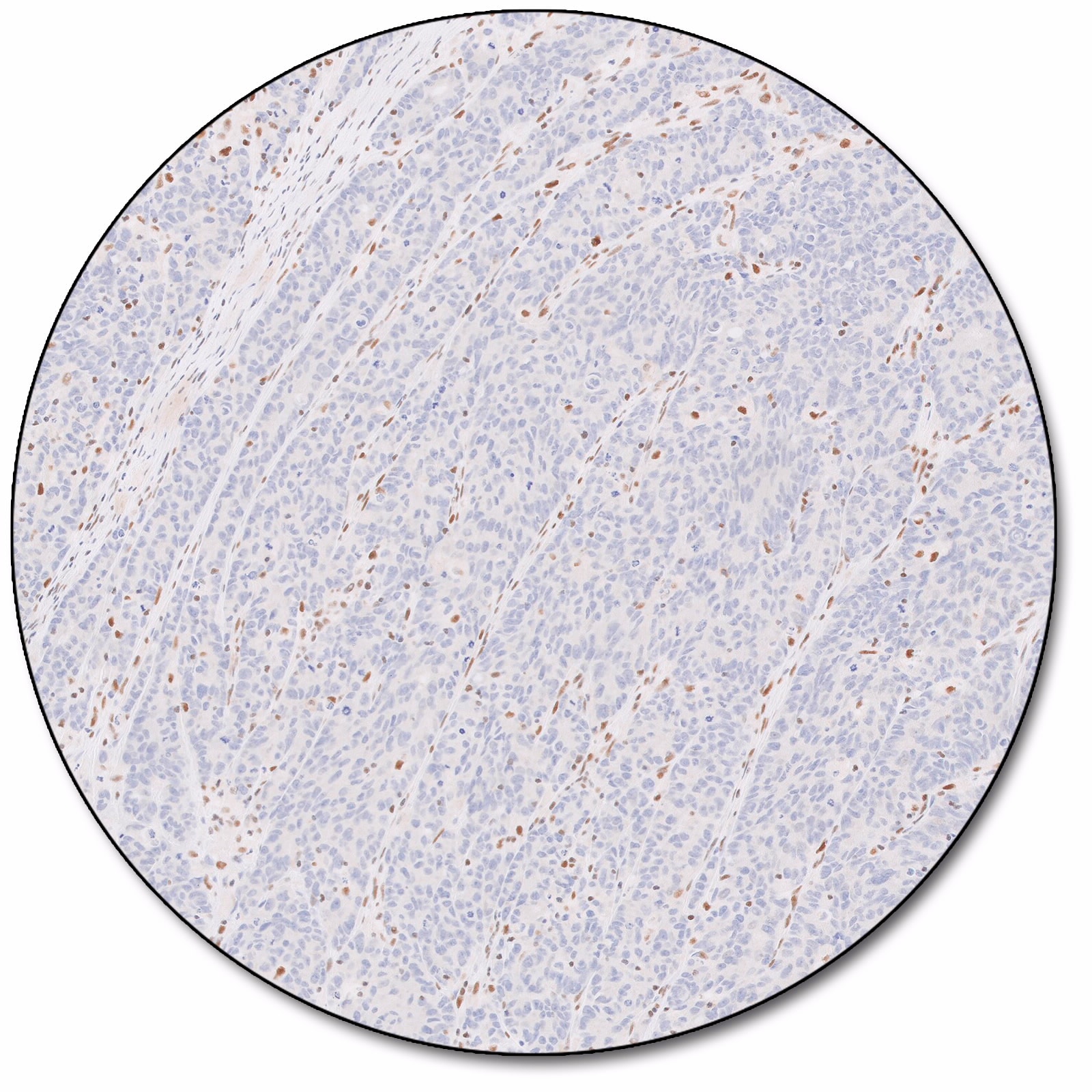 MutL Protein Homolog 1 (Dako Omnis)