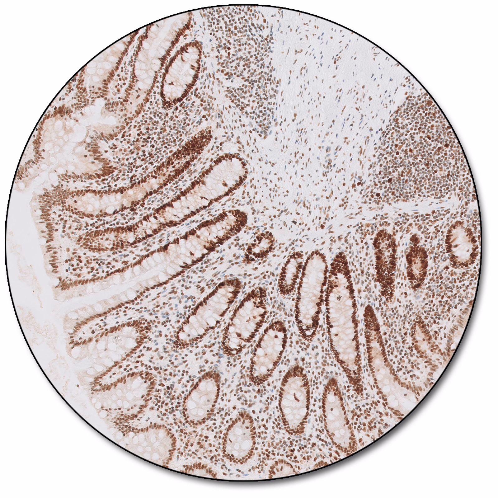 MutS Protein Homolog 2 (Dako Omnis)