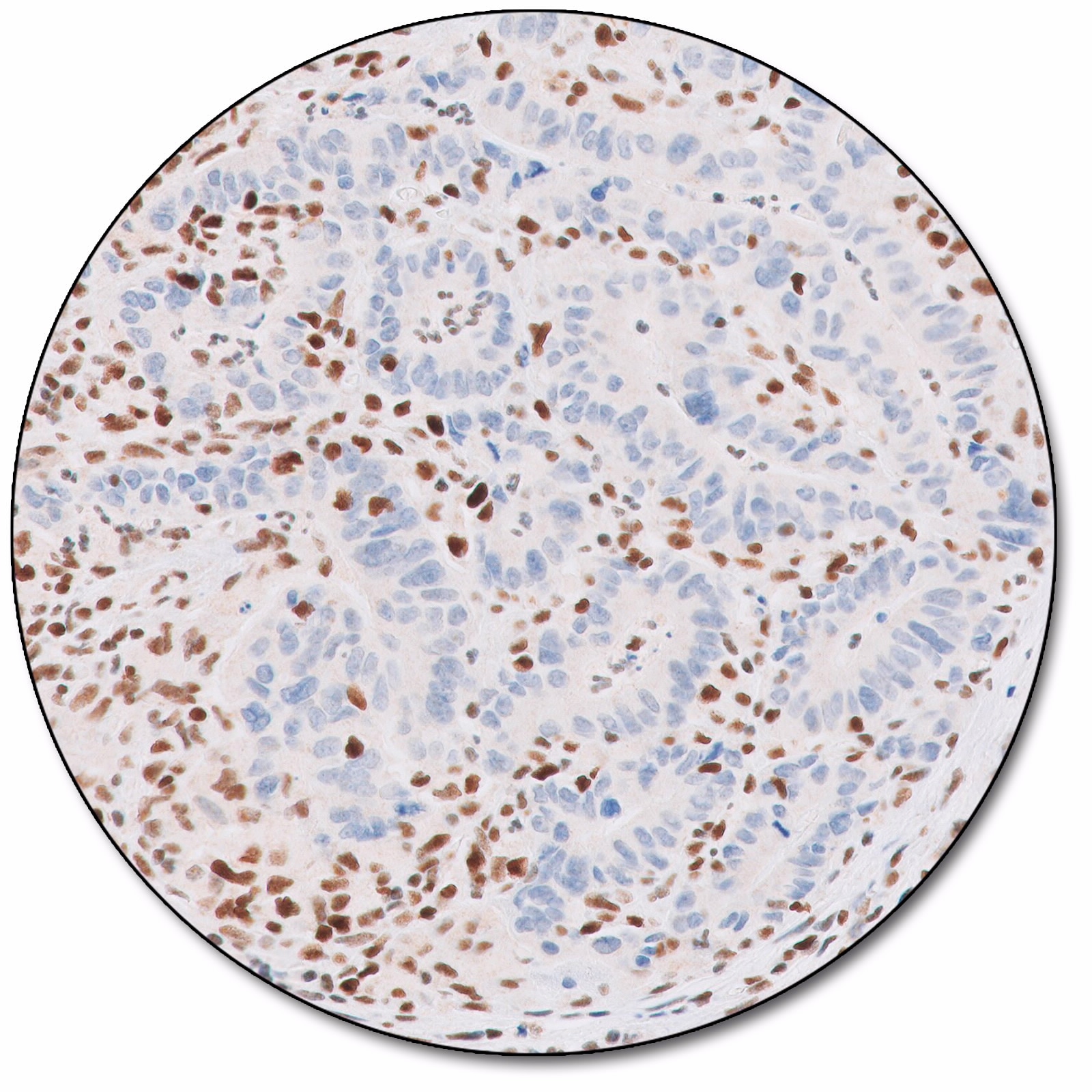 MutS Protein Homolog 2 (Dako Omnis)