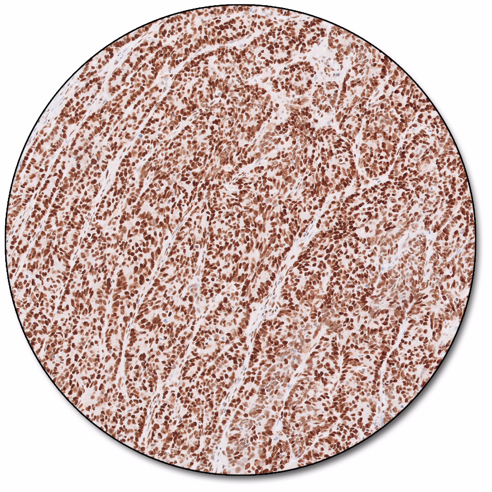 MutS Protein Homolog 2 (Dako Omnis)