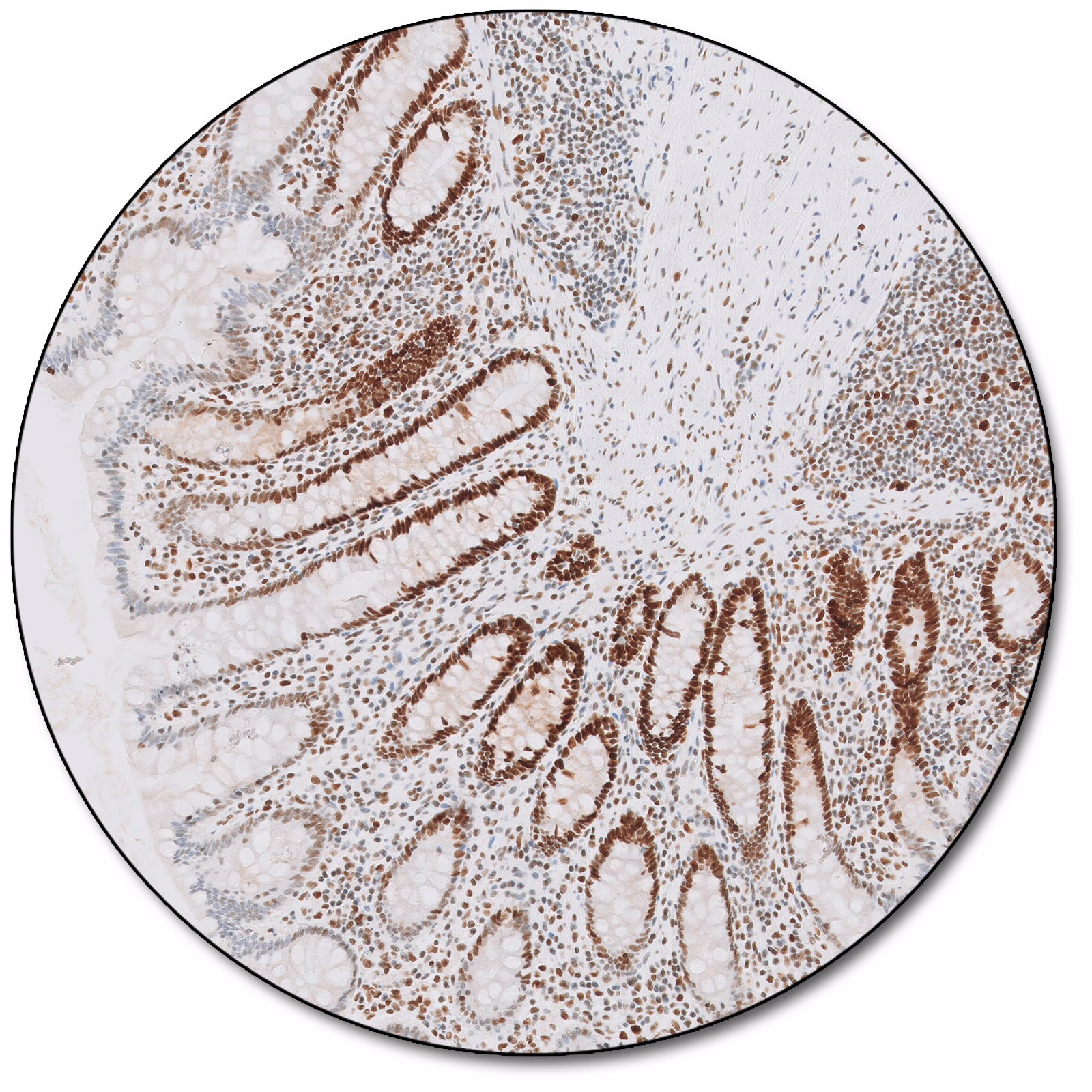 MutS Protein Homolog 6 (Dako Omnis)