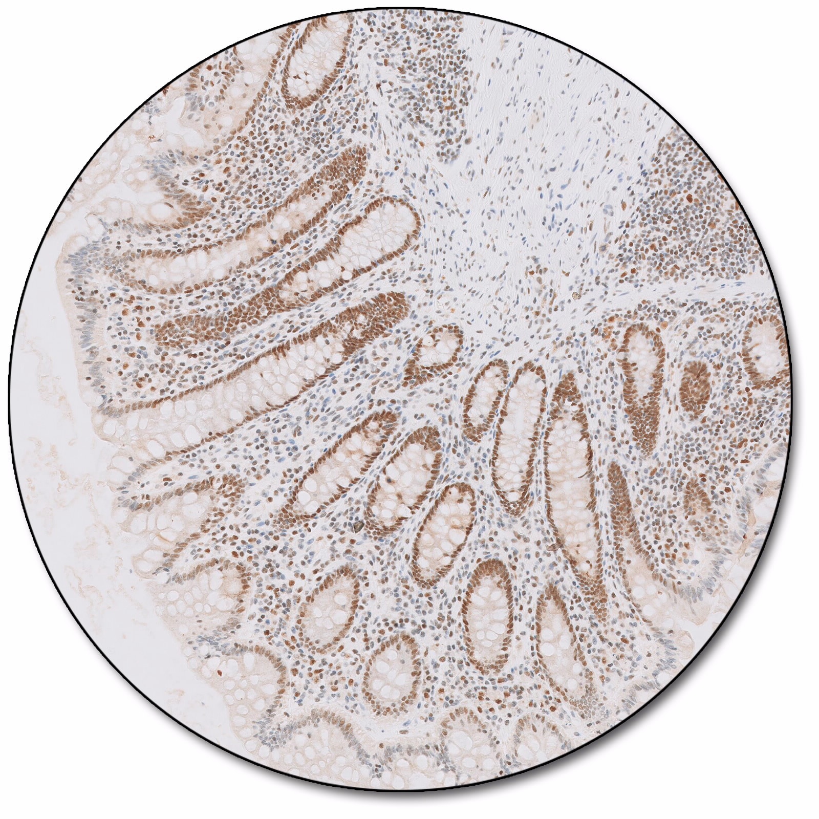 Postmeiotic Segregation Increased 2 (Dako Omnis)