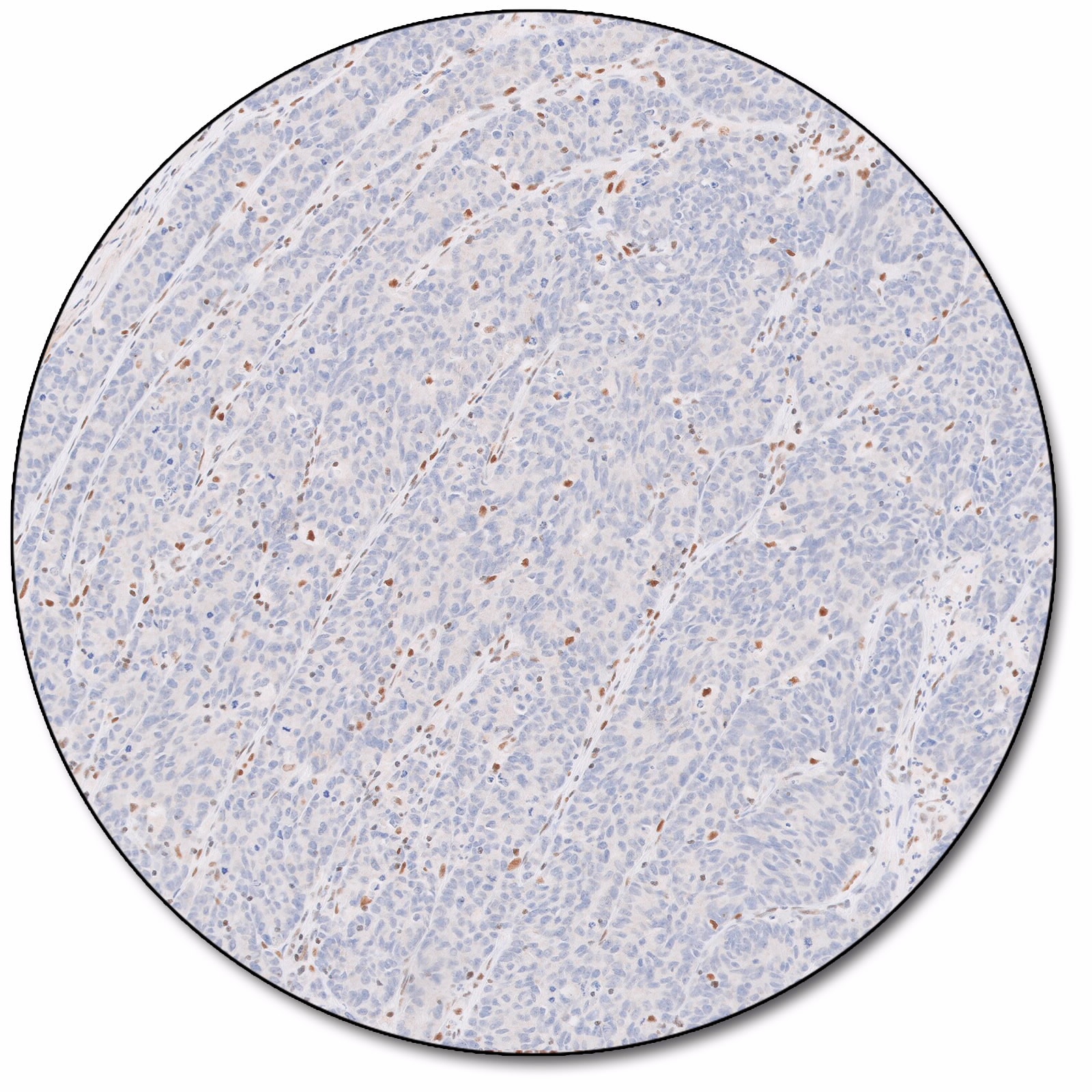 Postmeiotic Segregation Increased 2 (Dako Omnis)