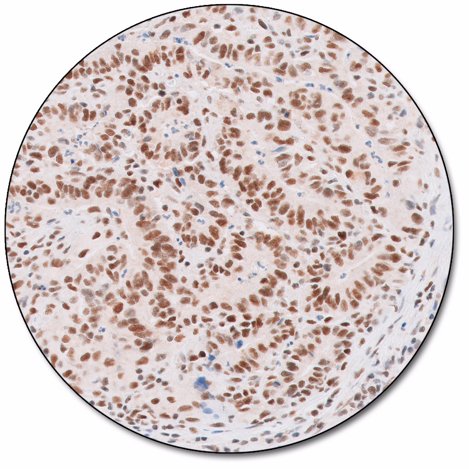 Postmeiotic Segregation Increased 2 (Dako Omnis)