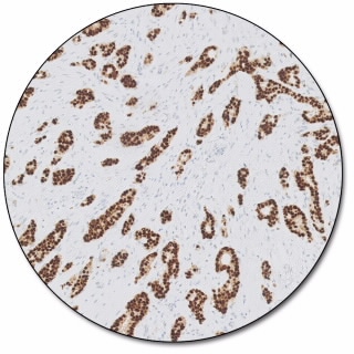 Progesterone Receptor (Dako Omnis)