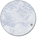 Progesterone Receptor (Dako Omnis)