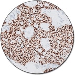 Progesterone Receptor (Dako Omnis)