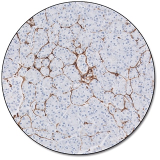 Actin (Smooth Muscle) (Dako Omnis)