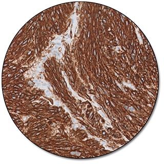 Actin (Smooth Muscle) (Dako Omnis)