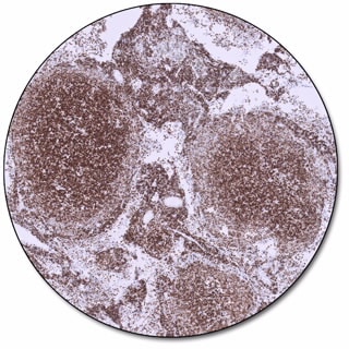 BCL2 Oncoprotein (Dako Omnis)