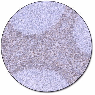BCL2 Oncoprotein (Dako Omnis)