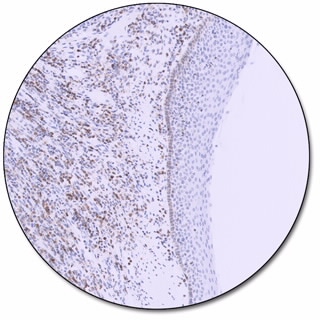 BCL2 Oncoprotein (Dako Omnis)